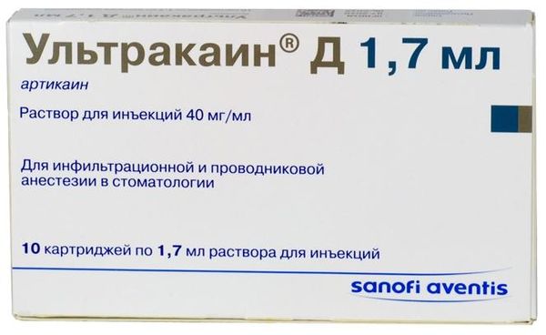 Фотография товара Ультракаин Д раствор для инъекций картридж 40мг/мл 1,7мл 10шт